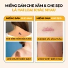 Miếng dán che sẹo Bellena XS2 65k - che mụn, nốt ruồi, sẹo lồi, khuyết điểm 2