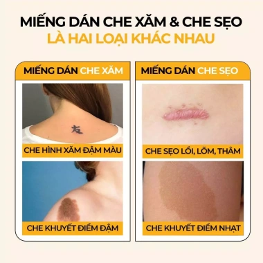 Miếng dán che sẹo Bellena XS2 65k - che mụn, nốt ruồi, sẹo lồi, khuyết điểm 2 Miếng dán che sẹo Bellena XS2 65k - che mụn, nốt ruồi, sẹo lồi, khuyết điểm 2
