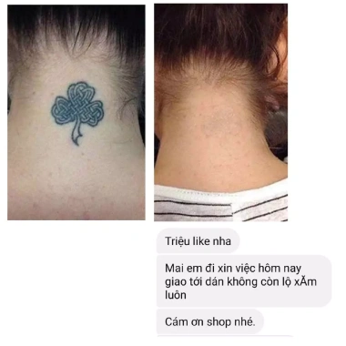 Miếng dán che sẹo Bellena XS2 65k - che mụn, nốt ruồi, sẹo lồi, khuyết điểm