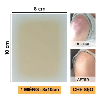 Miếng dán che sẹo Bellena XS2 65k - che mụn, nốt ruồi, sẹo lồi, khuyết điểm
