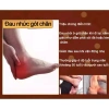 Miếng Dán Giảm Đau Gót Chân, Cổ Vai Gáy - Hỗ Trợ Gout và Cột Sống - Chỉ 81.000₫ 5