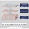 Miếng Dán Giảm Đau Huyệt Đạo Cổ - Giảm Thoái Hóa Đốt Sống Cổ Vai Gáy 5m 69.000 VND 7