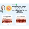 Miếng Dán Giảm Đau PIP ELEKIBAN MAX 200MT Nhật Bản Thoái Hóa Vai Gáy, Lưng, Chân 3