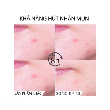 Miếng Dán Giảm Mụn Some By Mi Clear Spot Patch 18 miếng - 10mm & 12mm, Giá 99.000 VND 5