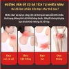 Miếng Dán Gừng Nóng Giảm Đau Vai Gáy, Lưng, Khớp Thảo Dược Giữ Ấm, Giảm Tê Mỏi, Giá 25.000đ 2