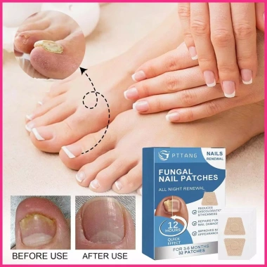 Miếng Dán Móng Siêu Mỏng 18 Miếng - Đổi Màu, Tăng Cường, Giá Ưu Đãi 101,200₫