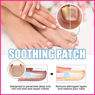 Miếng Dán Móng Siêu Mỏng 18 Miếng - Đổi Màu, Tăng Cường, Giá Ưu Đãi 101,200₫