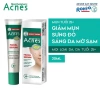 Miếng dán mụn 24m + kem chấm mụn 25+ serum, kem mờ sẹo 18g, gel đầu đen 18g - Giá chỉ 42.000₫ 10