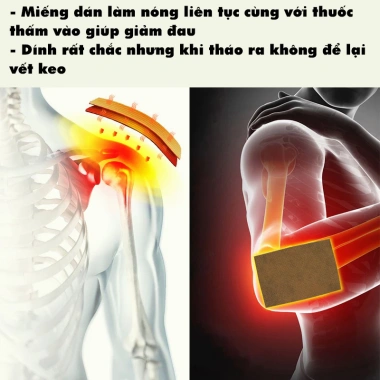 Miếng Pad Dán Giảm Đau Cơ Khớp 10 Hộp - Cao Dán Nóng, Thảo Mộc, Giảm Nhức Cổ Vai Gáy Lưng, Giá 60.000₫ 5