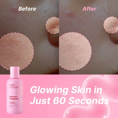 [MỚI] Mặt nạ lột mềm Dewy 9 LEPS – Serum Peeling Gel 105ml, da sáng mịn, tẩy tế bào chết nhẹ nhàng 2