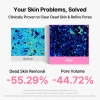 [MỚI] Mặt nạ lột mềm Dewy 9 LEPS – Serum Peeling Gel 105ml, da sáng mịn, tẩy tế bào chết nhẹ nhàng 5