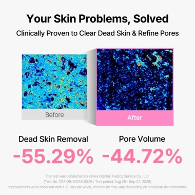 [MỚI] Mặt nạ lột mềm Dewy 9 LEPS – Serum Peeling Gel 105ml, da sáng mịn, tẩy tế bào chết nhẹ nhàng 5