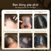 Mua 1 được 5 Xịt mọc tóc Lab on Hair 160ml - Giá ưu đãi 693k, hỗ trợ tóc hư tổn nhanh 3