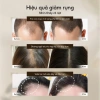 Mua 1 được 5 Xịt mọc tóc Lab on Hair 160ml - Giá ưu đãi 693k, hỗ trợ tóc hư tổn nhanh 5