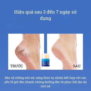 Mua 1 Tặng 1 Kem Dưỡng Da Chống Nứt Nẻ Gót Chân Dạng Lăn EOURHSA - Giá chỉ 65k 2