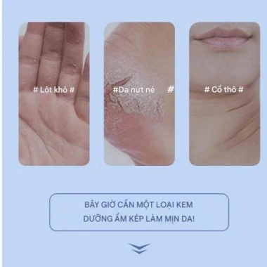 Mua 1 Tặng 1 Kem Dưỡng Da Chống Nứt Nẻ Gót Chân Dạng Lăn EOURHSA - Giá chỉ 65k 4