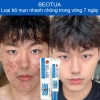 Mua 2 tặng 1 Kem chấm mụn cấp tốc 25g, loại bỏ mụn đầu đen, mụn tuổi dậy thì, da dầu, giá chỉ 60.000