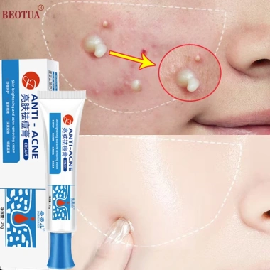 Mua 2 tặng 1 Kem chấm mụn cấp tốc 25g, loại bỏ mụn đầu đen, mụn tuổi dậy thì, da dầu, giá chỉ 60.000
