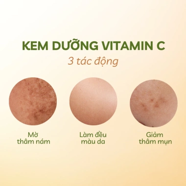 Mua 2 Tặng 2 Bộ Đôi Kem Dưỡng Vitamin C Sáng Da Mờ Thâm Nám Tàn Nhang 940k 7