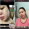 Mua 7 tặng 2 Trọn Bộ Facial Skincare Barbie Skin - Giảm 16% Chăm sóc da mặt 9