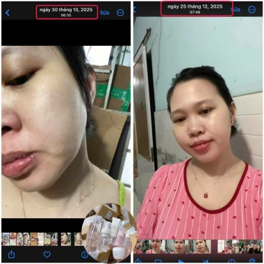 Mua 7 tặng 2 Trọn Bộ Facial Skincare Barbie Skin - Giảm 16% Chăm sóc da mặt