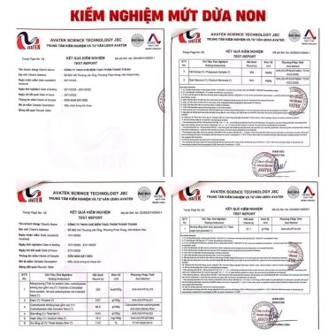 Mứt dừa non sợi to dẻo mềm 200g combo gừng mật ong và hạt điều giảm còn 160.550 VND