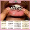 MYPANDA Grillz Kim Loại Hip Hop Vàng Bạc Răng Nướng Tháo Rời Punk Cosplay Tiệc