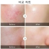 Nạ Bạc 1 Hộp 50 Miếng Mặt Nạ B5 BelV - Dưỡng Trắng Da, Phục Hồi Da, Giá 58.410 VND 2