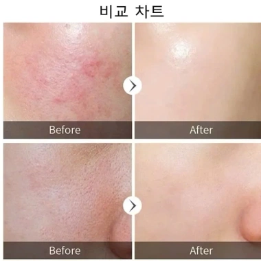 Nạ Bạc 1 Hộp 50 Miếng Mặt Nạ B5 BelV - Dưỡng Trắng Da, Phục Hồi Da, Giá 58.410 VND