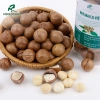 Nhân Óc Chó Vàng Sạch Tách Vỏ Úc 400g - Hàng Khô Dày Ngon, Bổ Dưỡng Bà Bầu & Trẻ Em, Giá Ưu Đãi 215k 2