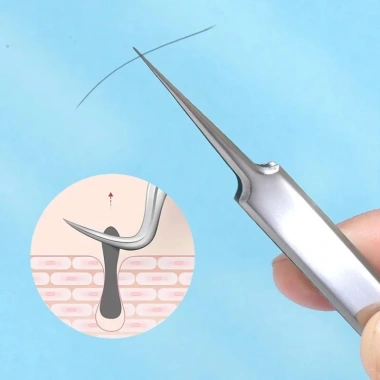 [NHẬP KHẨU] Nhíp Gắp Mụn LMLTOP Acne Clips - An Toàn, Hiệu Quả, Giá 25.000₫ 5
