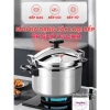 Nồi áp suất đáy từ Fujika chính hãng 4-7L đa năng, bảo hành 12 tháng, chỉ 349.000₫