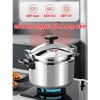 Nồi áp suất Fujika đáy từ đa năng 4-7L, dùng được mọi bếp, bảo hành 12 tháng - Giá chỉ 489.000₫ 5
