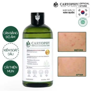 Nước Cân Bằng Da CARYOPHY Portulaca Toner 300ml Giá 290.000 Dưỡng ẩm Cân bằng pH 3 Nước Cân Bằng Da CARYOPHY Portulaca Toner 300ml Giá 290.000 Dưỡng ẩm Cân bằng pH 3