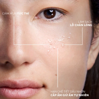 Nước cân bằng khoáng da dầu La Roche-Posay Effaclar 200ml - Giá chỉ 466.000đ