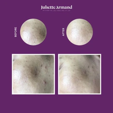 Nước cân bằng Toner Juliette Armand AHA Lotion dưỡng ẩm làm sáng da giảm mụn giá ưu đãi 1.130.000₫