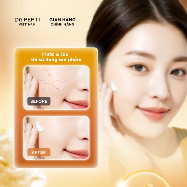Nước Hoa Hồng Dr.Pepti Centella Toner Ex 180ml - Cấp ẩm, Da Căng Bóng, Giá 95k 7 Nước Hoa Hồng Dr.Pepti Centella Toner Ex 180ml - Cấp ẩm, Da Căng Bóng, Giá 95k 7