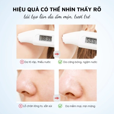 Nước Hoa Hồng Dưỡng Ẩm Vitamin E & Glycerin – Cân Bằng, Làm Dịu, Phục Hồi Cháy Nắng 6