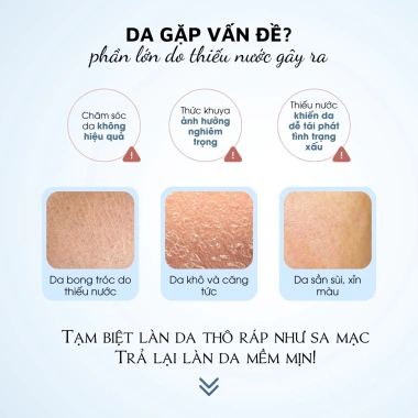 Nước Hoa Hồng Dưỡng Ẩm Vitamin E & Glycerin – Cân Bằng, Làm Dịu, Phục Hồi Cháy Nắng 7