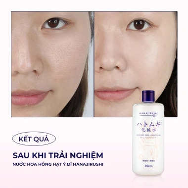 Nước Hoa Hồng HATOMUGI Trắng Da, Giảm Viêm, Dưỡng ẩm 500ml COIX SEED Conditioner