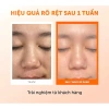 Nước hoa hồng Klairs Freshly Juiced Vitamin Essence Toner 180ml - Dưỡng sáng da, giảm giá 100.000đ 7