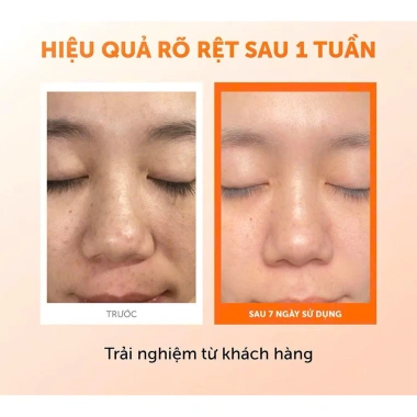 Nước hoa hồng Klairs Freshly Juiced Vitamin Essence Toner 180ml - Dưỡng sáng da, giảm giá 100.000đ 7 Nước hoa hồng Klairs Freshly Juiced Vitamin Essence Toner 180ml - Dưỡng sáng da, giảm giá 100.000đ 7