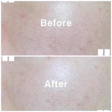 Nước Hoa Hồng Skin1.004 Centella Madagascar 210ml – Dưỡng ẩm nhẹ, phục hồi da, giảm giá 352.560đ 5