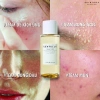 Nước hoa hồng SKIN1.004 Madagascar Centella Toner 210ml - Dưỡng ẩm, làm dịu da, giảm mụn, giá ưu đãi 358.000đ 6