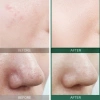 Nước hoa hồng Some By Mi AHA BHA PHA 30 Days Miracle Toner - Chỉ 288.000₫ 4
