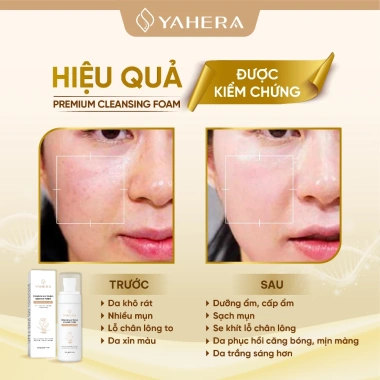 Nước hoa hồng YAHERA Premium Whitening Essence Toner 120ml - Dưỡng trắng, sạch sâu, cân bằng pH, chỉ 250k