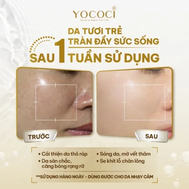 Nước Hoa Hồng Yococi Perfect Oolong Toner 110g - Dưỡng ẩm nhẹ, cân bằng pH, da mịn màng, giá ưu đãi 164k