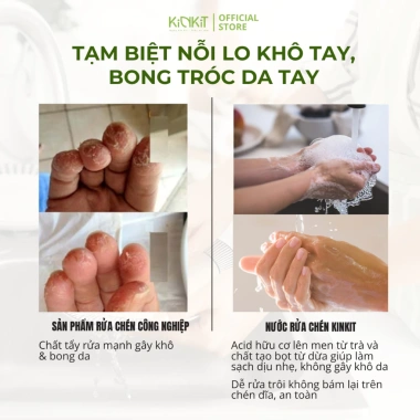 Nước Rửa Tay Trà Thảo Mộc KinKít 310ml - Diệt Khuẩn, Dưỡng Ẩm, An Toàn Cho Bé, Mua 2 Tặng 1 5