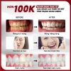 Nước Súc Miệng DrKam 250ml Chuẩn Y Khoa - Khử Hôi, Giảm Viêm Nướu, Không Cồn, Không Cay - 185.000 VND 4