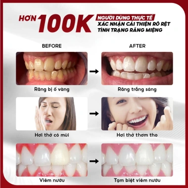 Nước Súc Miệng DrKam 250ml Chuẩn Y Khoa - Khử Hôi, Giảm Viêm Nướu, Không Cồn, Không Cay - 185.000 VND 4